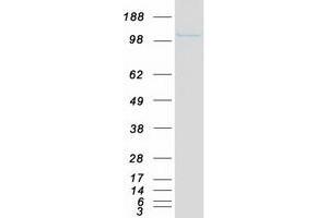 Western Blotting (WB) image for Proteasome (Prosome, Macropain) 26S Subunit, Non-ATPase, 2 (PSMD2) protein (Myc-DYKDDDDK Tag) (ABIN2729996)