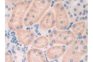 Immunohistochemistry (IHC) image for anti-Myosin, Light Chain 6B, Alkali, Smooth Muscle and Non-Muscle (MYL6B) (AA 6-137) antibody (ABIN7439591)
