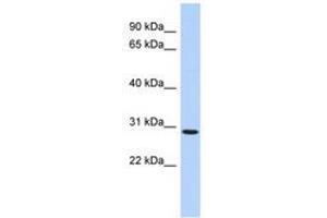 Image no. 1 for anti-SERTA Domain Containing 2 (SERTAD2) (AA 35-84) antibody (ABIN6741105)