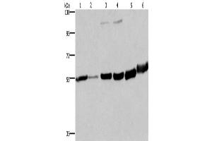 Western Blotting (WB) image for anti-Melanin-Concentrating Hormone Receptor 1 (MCHR1) antibody (ABIN2434978) (MCHR1 抗体)