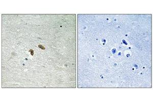 Immunohistochemical analysis of paraffin-embedded human brain tissue using C-RAF (Phospho-Thr269) antibody (left)or the same antibody preincubated with blocking peptide (right). (RAF1 抗体  (pThr269))