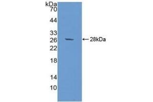 Detection of Recombinant SIRPa, Human using Polyclonal Antibody to Signal Regulatory Protein Alpha (SIRPa) (SIRPA 抗体  (AA 105-324))