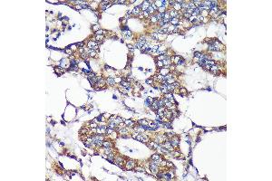 Immunohistochemistry of paraffin-embedded Human colon carcinoma using SLIRP Rabbit pAb (ABIN7270560) at dilution of 1:100 (40x lens).