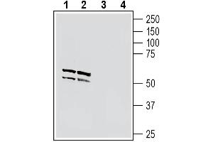anti-Neuronal Pentraxin 1 (NPX1) (AA 197-211), (Secreted) antibody