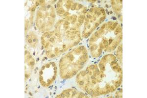 Immunohistochemistry of paraffin-embedded human kidney using ADCK3 antibody (ABIN5975514) at dilution of 1/100 (40x lens). (COQ8A 抗体)
