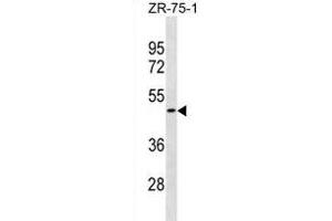 OR1S2 Antibody (C-term) (ABIN1881599 and ABIN2838716) western blot analysis in ZR-75-1 cell line lysates (35 μg/lane). (OR1S2 抗体  (C-Term))