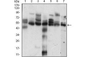 Western blot analysis using CCNE1 mouse mAb against Hela (1), K562 (2), NIH/3T3 (3), C6 (4), MCF-7 (5), Jurkat (6), A431 (7) cell lysate. (Cyclin E1 抗体  (AA 307-410))