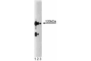 Western blot analysis of CASK on a rat cerebrum lysate. (CASK 抗体  (AA 353-486))