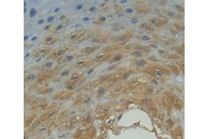 IHC-P analysis of esophagus tissue, with DAB staining. (FPGT 抗体  (AA 127-377))