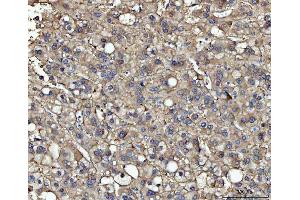 IHC analysis of ME1 using anti-ME1 antibody (ABIN7599485).