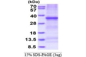 TNFRSF6B Protein (AA 30-300) (His tag)
