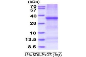 SDS-PAGE (SDS) image for Tumor Necrosis Factor Receptor Superfamily, Member 6b, Decoy (TNFRSF6B) (AA 30-300) protein (His tag) (ABIN5853355) (TNFRSF6B Protein (AA 30-300) (His tag))