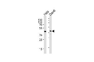 Lane 1: HeLa Cell lysates, Lane 2: Daudi Cell lysates, probed with USF1 (1264CT170. (USF1 抗体)