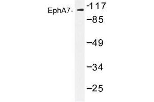 Image no. 1 for anti-EPH Receptor A7 (EPHA7) antibody (ABIN272234) (EPH Receptor A7 抗体)
