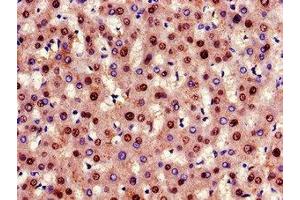 Immunohistochemistry of paraffin-embedded human liver tissue using ABIN7153869 at dilution of 1:100 (Glucagon Receptor 抗体  (AA 26-136))