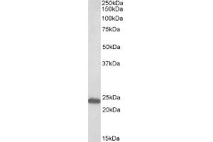 ABIN625812 (0. (GM2A 抗体  (AA 164-175))