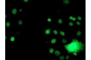 Anti-GSTT2 mouse monoclonal antibody (ABIN2453879) immunofluorescent staining of COS7 cells transiently transfected by pCMV6-ENTRY GSTT2 (RC200040). (GSTT2 抗体)