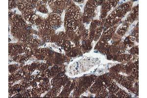 Immunohistochemical staining of paraffin-embedded Human liver tissue using anti-CYP2A6 mouse monoclonal antibody. (CYP2A6 抗体)