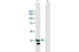 Western Blot analysis of ADAM22 expression in transfected 293T cell line by ADAM22 MaxPab polyclonal antibody. (ADAM22 抗体  (AA 1-342))