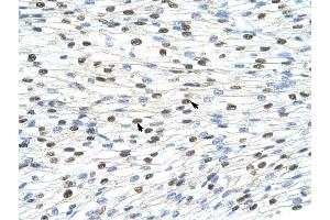 DAZAP1 antibody was used for immunohistochemistry at a concentration of 4-8 ug/ml to stain Myocardial cells (arrows) in Human Heart. (DAZAP1 抗体  (C-Term))