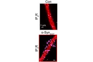 Representative confocal images of control and α-SynA53T -transfected mouse neurons with MAP2-labeled dendrites (red) stained for IP3R1 ((ABIN1304718), magenta).