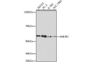Western blot analysis of extracts of various cell lines, using  Rabbit mAb (ABIN7265630) at 1:1000 dilution.