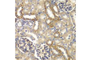 Immunohistochemistry of paraffin-embedded rat kidney using RAB5C antibody. (Rab5c 抗体  (AA 1-216))