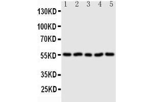 Anti-Syndecan 3 antibody, Western blotting Lane 1: U87 Cell Lysate Lane 2: 293T Cell Lysate Lane 3: PC-12 Cell Lysate Lane 4: NRK Cell Lysate Lane 5:  Cell Lysate (SDC3 抗体  (N-Term))