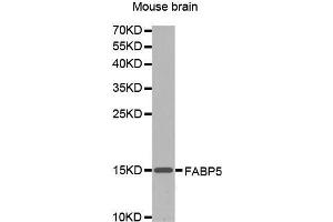 Western Blotting (WB) image for anti-Fatty Acid Binding Protein 5 (Psoriasis-Associated) (FABP5) (AA 1-100) antibody (ABIN1679794) (FABP5 抗体  (AA 1-100))