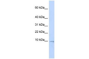 UCRC antibody used at 1 ug/ml to detect target protein. (UQCR10 抗体)