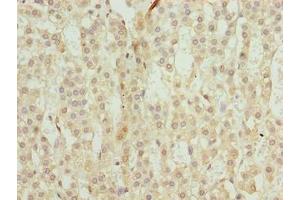 Immunohistochemistry of paraffin-embedded human adrenal gland tissue using ABIN7172369 at dilution of 1:100 (TRAPPC6B 抗体  (AA 1-130))