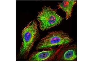 Immunofluorescence (IF) image for anti-Glypican 3 (GPC3) antibody (ABIN1107403) (Glypican 3 抗体)