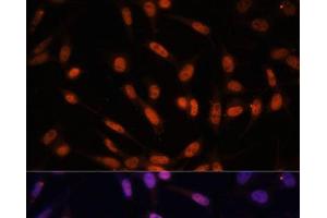 Immunofluorescence analysis of NIH/3T3 cells using Twist Polyclonal Antibody at dilution of 1:100. (TWIST1 抗体)