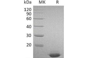 Western Blotting (WB) image for Interferon, alpha 2 (IFNA2) protein (ABIN7320562) (IFNA2 蛋白)
