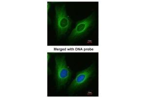 ICC/IF Image Immunofluorescence analysis of paraformaldehyde-fixed HeLa, using AKR1C3, antibody at 1:200 dilution.