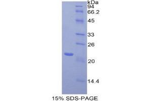 SDS-PAGE (SDS) image for Toll-Like Receptor 3 (TLR3) (AA 533-705) protein (His tag) (ABIN1877944) (TLR3 Protein (AA 533-705) (His tag))