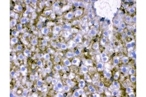 IHC analysis of SLC10A1 using anti-SLC10A1 antibody (ABIN3043337).