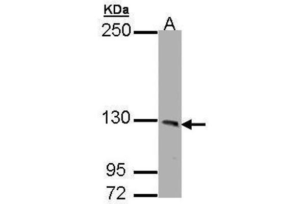 PHKA1 antibody  (C-Term)