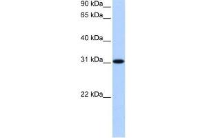 TNRC18 antibody used at 0. (TNRC18 抗体  (N-Term))