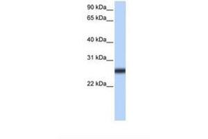 Image no. 1 for anti-Transmembrane Protease, serine 5 (TMPRSS5) (AA 270-319) antibody (ABIN6739260) (TMPRSS5 抗体  (AA 270-319))
