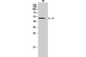 Western Blotting (WB) image for anti-Interleukin 7 Receptor (IL7R) (Internal Region) antibody (ABIN3181445) (IL7R 抗体  (Internal Region))