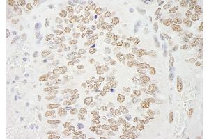 Immunohistochemistry (IHC) image for anti-Protein Arginine Methyltransferase 6 (PRMT6) (C-Term) antibody (ABIN7448744) (PRMT6 抗体  (C-Term))