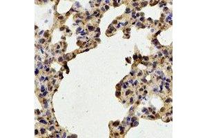 Immunohistochemistry (IHC) image for anti-Stress-Induced-phosphoprotein 1 (STIP1) antibody (ABIN7308382) (STIP1 抗体)