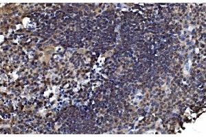 IHC analysis of OTULIN using anti-OTULIN antibody (ABIN7601854). (FAM105B 抗体  (AA 49-352))