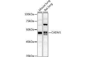 Western blot analysis of extracts of various cell lines, using C antibody (ABIN3022654, ABIN3022655, ABIN3022656 and ABIN6219028) at 1:1000 dilution. (CADM1 抗体  (AA 45-344))