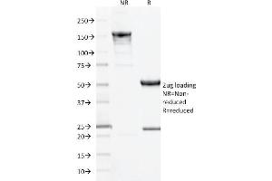 SDS-PAGE Analysis Purified CD10 Mouse Monoclonal Antibody (MME/1893). (MME 抗体  (AA 297-483))