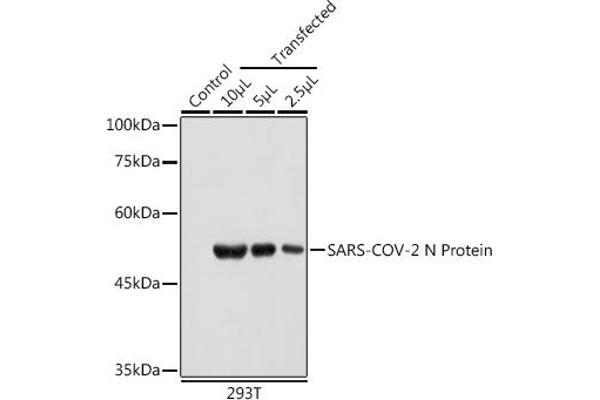 SARS-CoV-2 Nucleocapsid 抗体