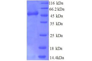 SYNCRIP Protein (AA 2-191, partial) (GST tag)
