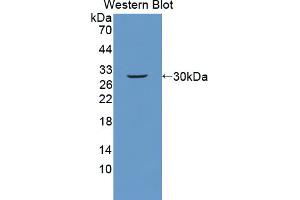 Western blot analysis of the recombinant protein. (PLXNB1 抗体  (AA 1598-1849))