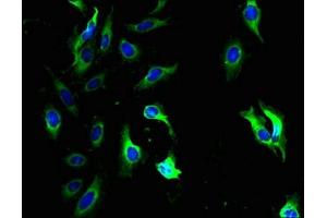 Immunofluorescent analysis of Hela cells using ABIN7154031 at dilution of 1:100 and Alexa Fluor 488-congugated AffiniPure Goat Anti-Rabbit IgG(H+L) (QPCTL 抗体  (AA 212-382))